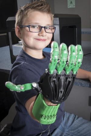Noah Muns shows off the work-in-progress prosthetic hand.